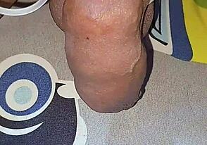 कभी घरेलू सलाइन इंजेक्शन ट्राई किया जैसे म्यांमार कॉकलवरएमएलएम?